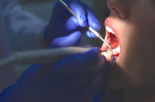 Image of a dentist looking inside someone's mouth. More funding made available for NHS dentists